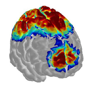 Functional Near-Infrared Spectroscopy (fNIRS)