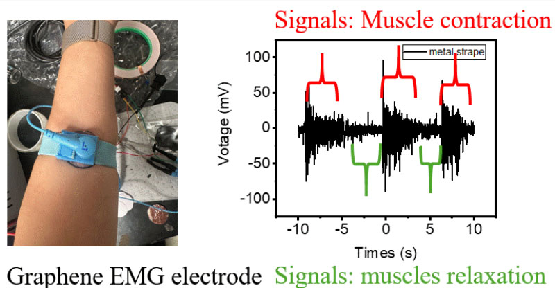 Graphene EMG Electrode